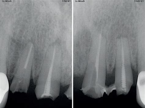 X-Rays: An Incisive Examination into the Inner Workings of Masterpieces